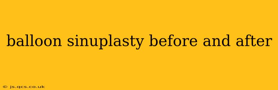 balloon sinuplasty before and after