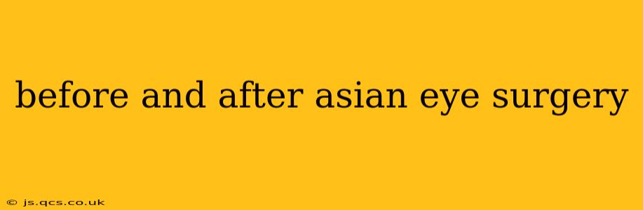 before and after asian eye surgery