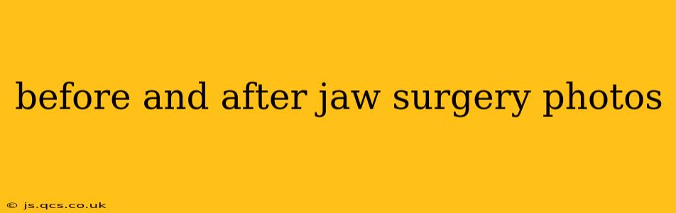 before and after jaw surgery photos