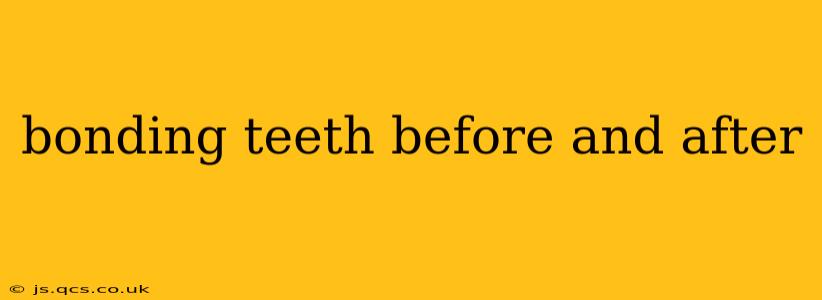 bonding teeth before and after