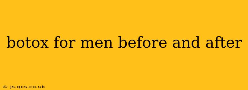 botox for men before and after