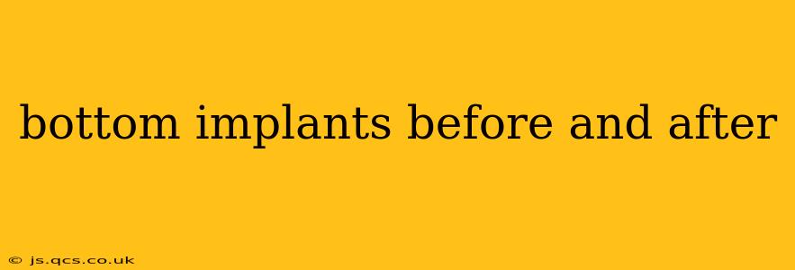 bottom implants before and after