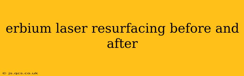 erbium laser resurfacing before and after