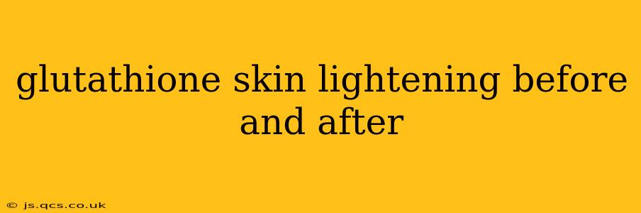 glutathione skin lightening before and after
