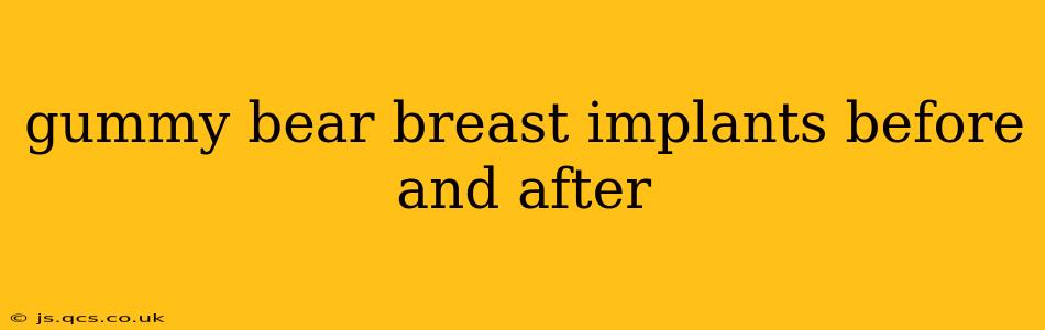 gummy bear breast implants before and after