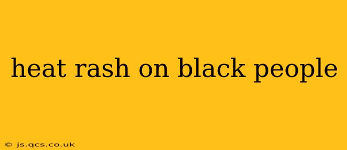 heat rash on black people