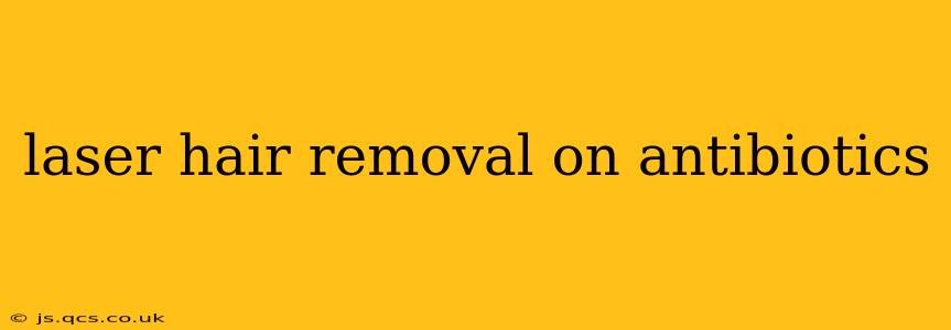 laser hair removal on antibiotics