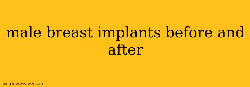 male breast implants before and after
