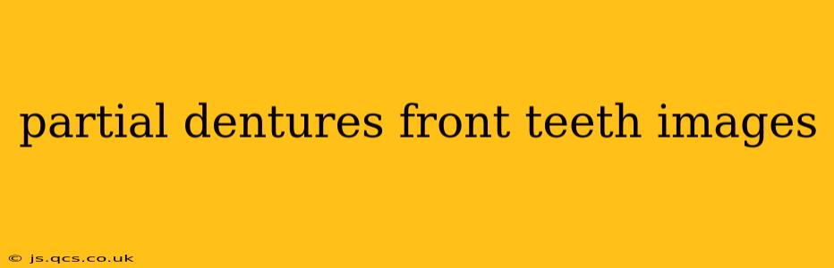 partial dentures front teeth images