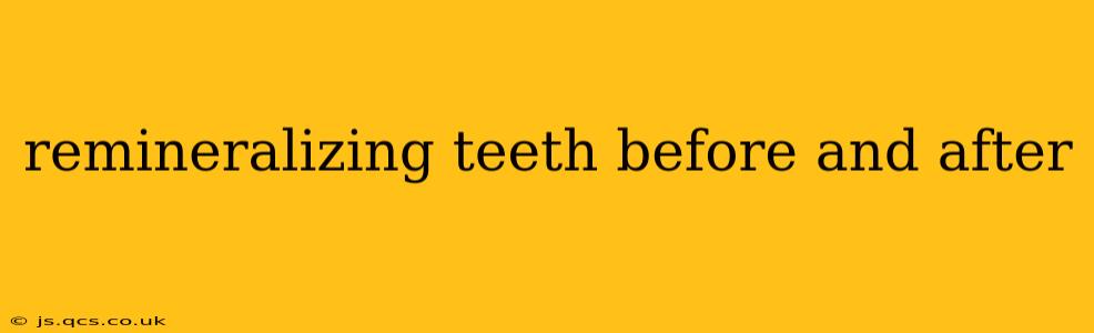remineralizing teeth before and after