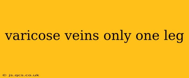 varicose veins only one leg