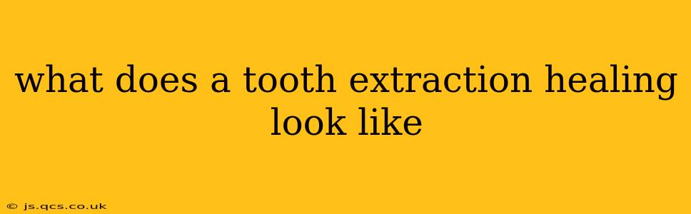 what does a tooth extraction healing look like