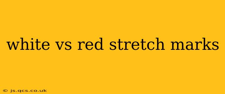 white vs red stretch marks