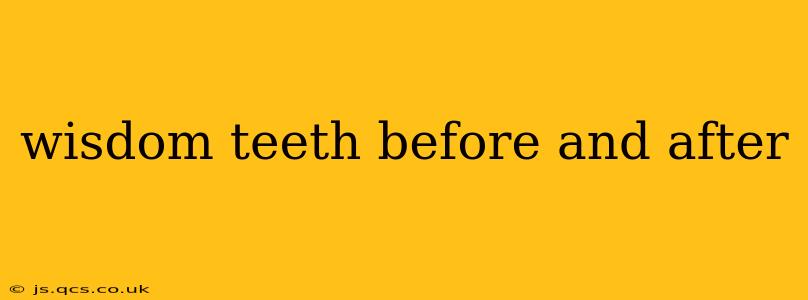 wisdom teeth before and after